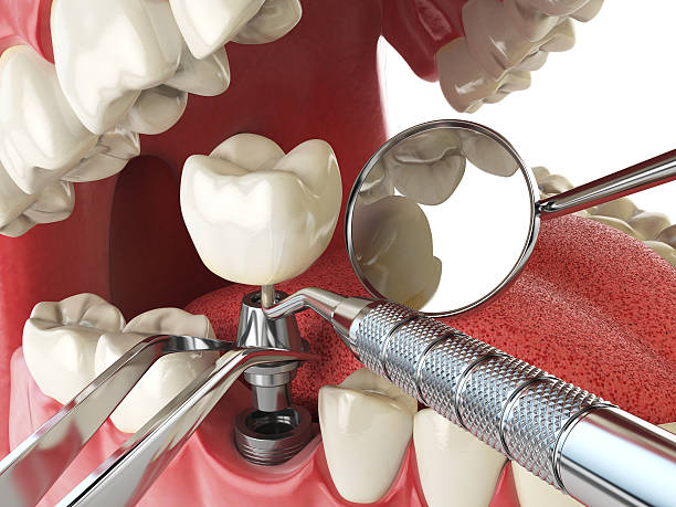 Best Emergency Treatment for Toothache in Delphos, OH